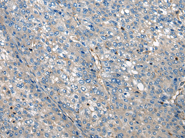Rabbit Polyclonal Antibody to CNOT4