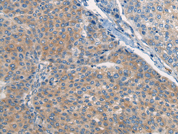 Rabbit Polyclonal Antibody to CNTN5