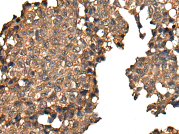 Rabbit Polyclonal Antibody to NELFB