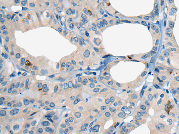 Rabbit Polyclonal Antibody to COL5A2