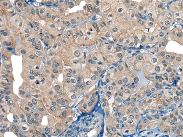 Rabbit Polyclonal Antibody to COP1