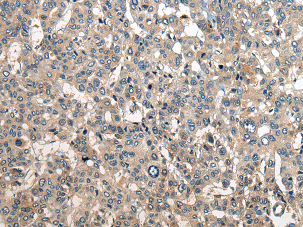 Rabbit Polyclonal Antibody to RCOR2