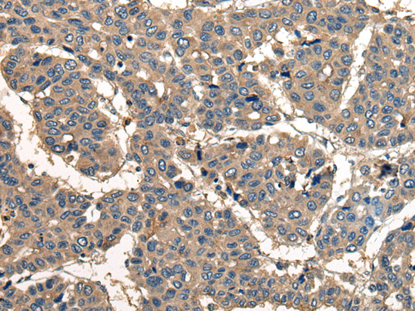 Rabbit Polyclonal Antibody to CORO1B