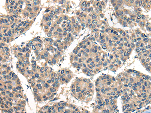 Rabbit Polyclonal Antibody to TACR3