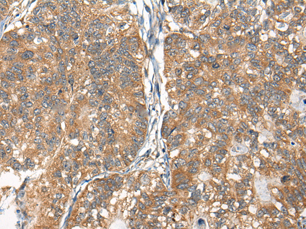 Rabbit Polyclonal Antibody to RTN4IP1