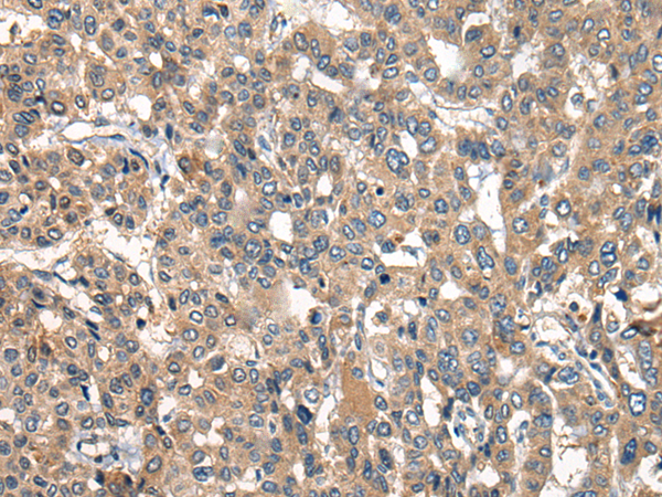 Rabbit Polyclonal Antibody to OAS3