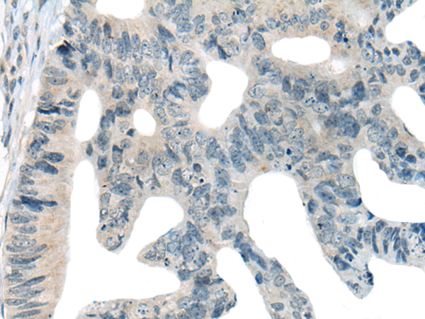 Rabbit Polyclonal Antibody to MAP2K7