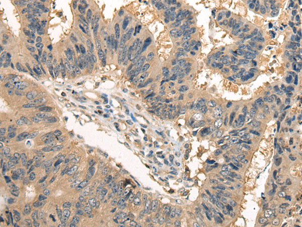 Rabbit Polyclonal Antibody to DNAJC2