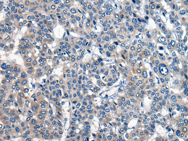 Rabbit Polyclonal Antibody to CDH17