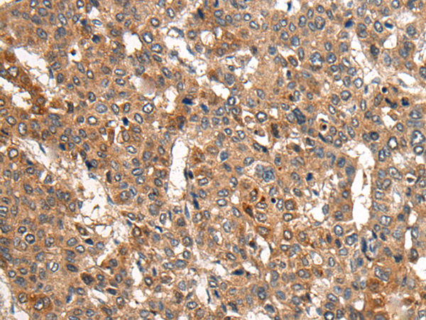 Rabbit Polyclonal Antibody to CDH23