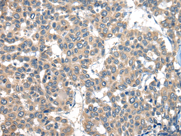 Rabbit Polyclonal Antibody to PDK1