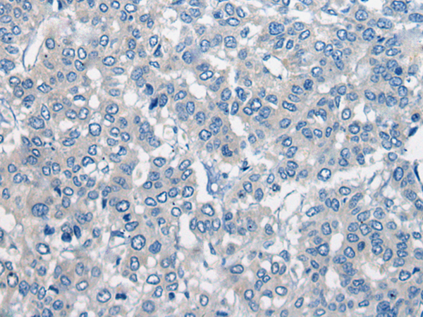 Rabbit Polyclonal Antibody to SLC15A1