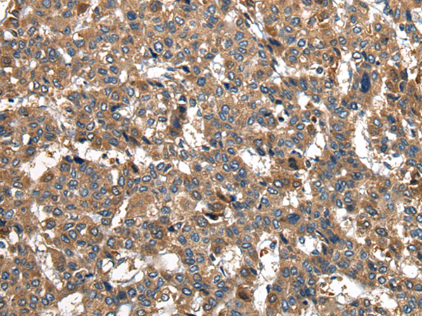 Rabbit Polyclonal Antibody to PIWIL2
