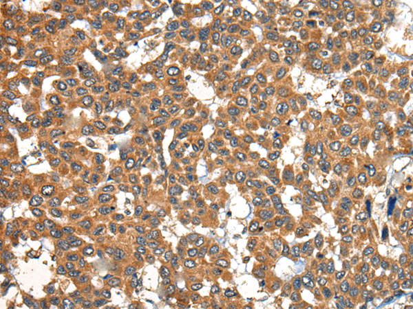 Rabbit Polyclonal Antibody to PMP22