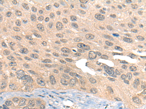 Rabbit Polyclonal Antibody to PRMT6