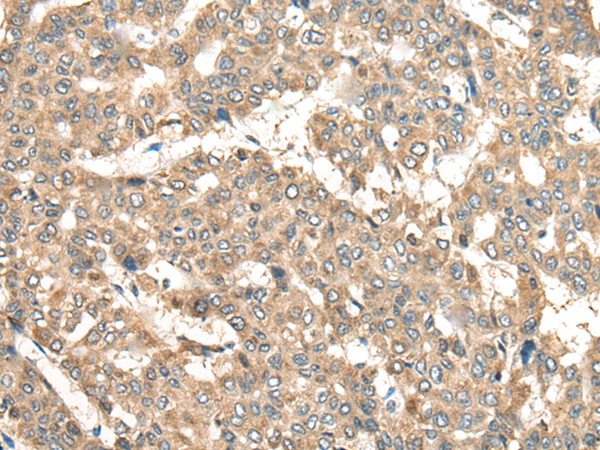 Rabbit Polyclonal Antibody to ADRA2A