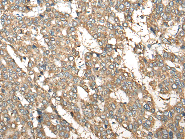 Rabbit Polyclonal Antibody to AIFM2