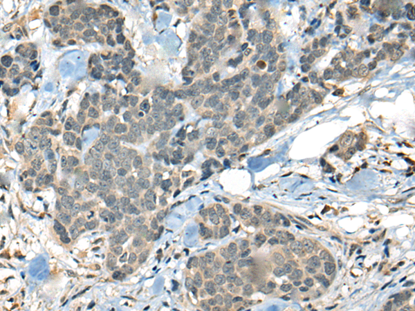 Rabbit Polyclonal Antibody to ARID1B