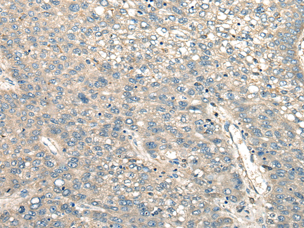 Rabbit Polyclonal Antibody to PIAS3
