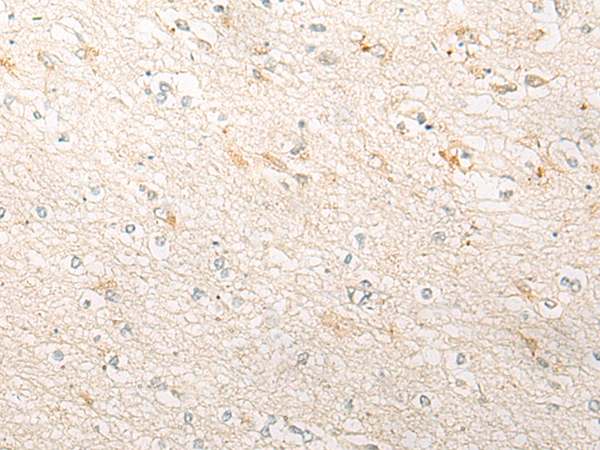 Rabbit Polyclonal Antibody to SLC9A3R1