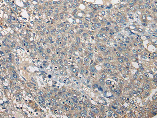 Rabbit Polyclonal Antibody to NRG2