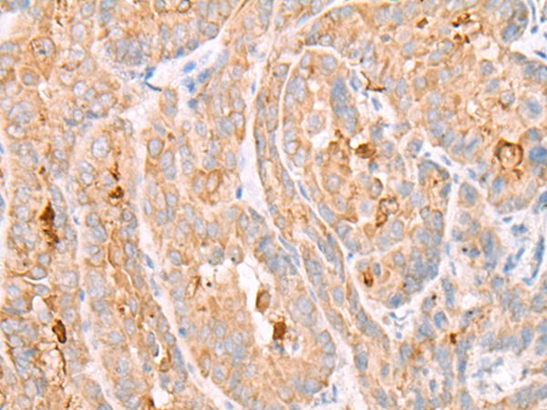 Rabbit Polyclonal Antibody to HIPK3