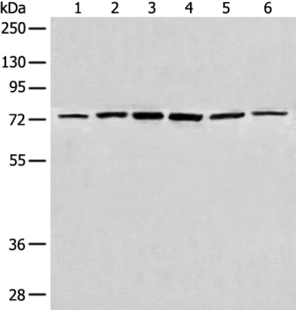 Rabbit Polyclonal Antibody to CHFR