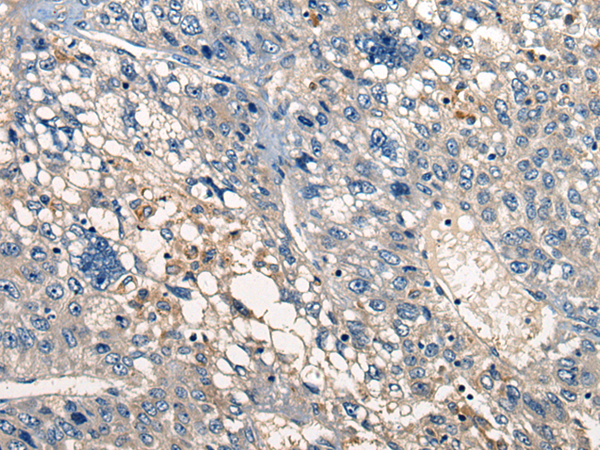 Rabbit Polyclonal Antibody to ACER1