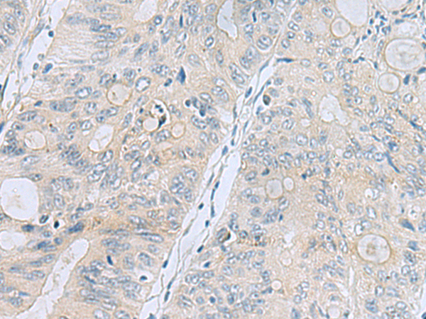 Rabbit Polyclonal Antibody to APOBR