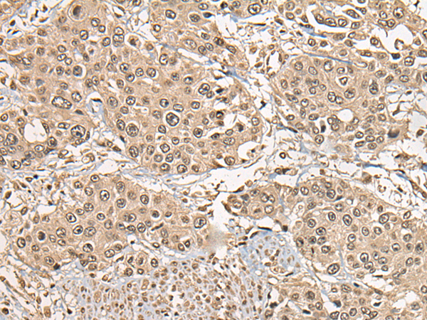 Rabbit Polyclonal Antibody to BRD8