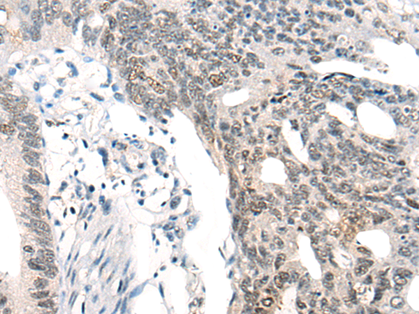 Rabbit Polyclonal Antibody to MBD2-b