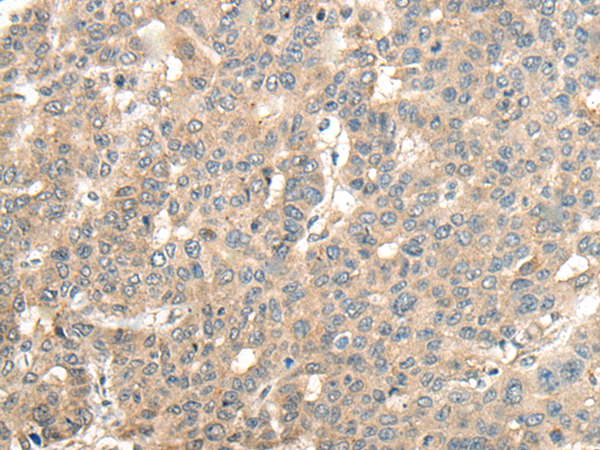 Rabbit Polyclonal Antibody to APC