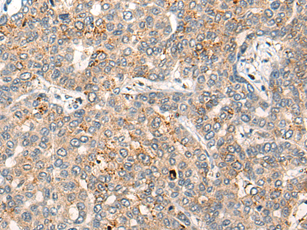 Rabbit Polyclonal Antibody to GLI3