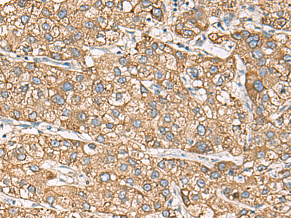 Rabbit Polyclonal Antibody to CMTM4