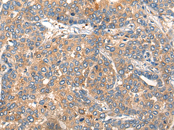 Rabbit Polyclonal Antibody to TNFRSF10D