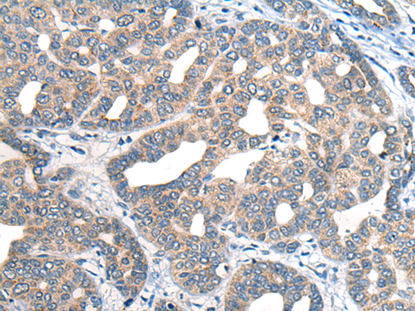 Rabbit Polyclonal Antibody to SCN5A