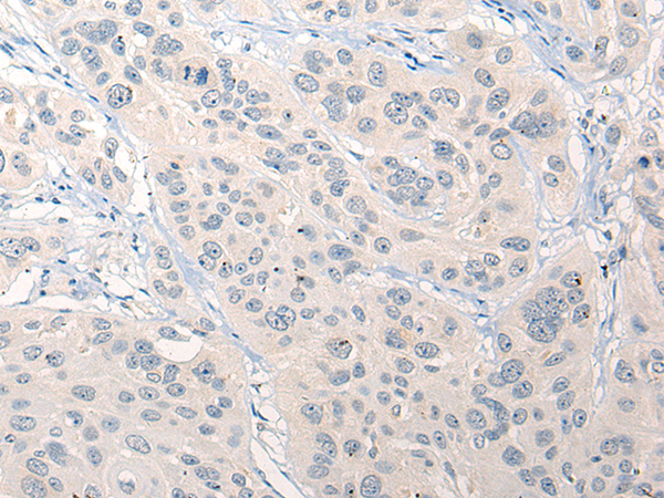 Rabbit Polyclonal Antibody to RNF138