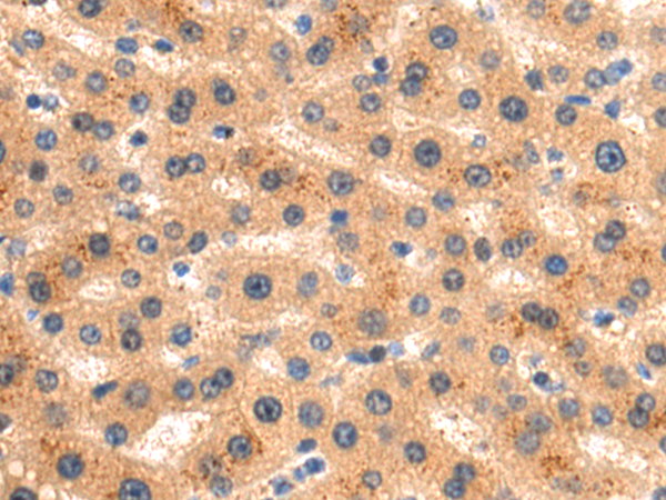 Rabbit Polyclonal Antibody to GASK1A