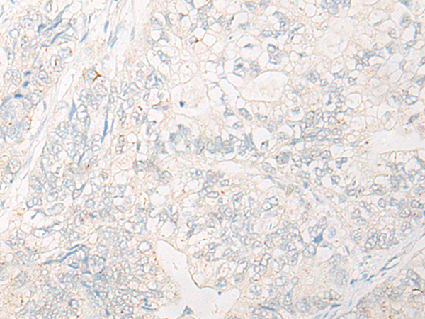 Rabbit Polyclonal Antibody to IGSF3