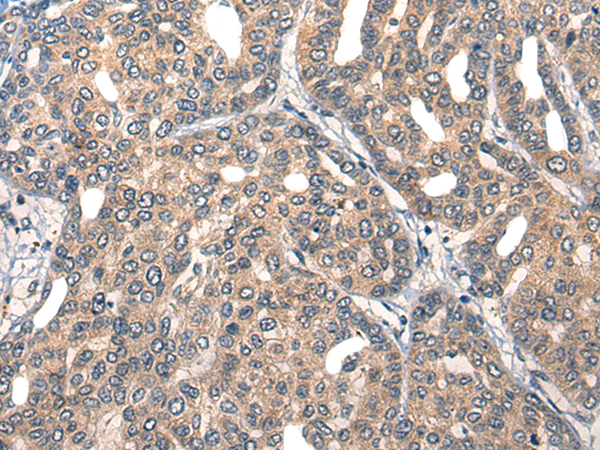 Rabbit Polyclonal Antibody to UBIAD1