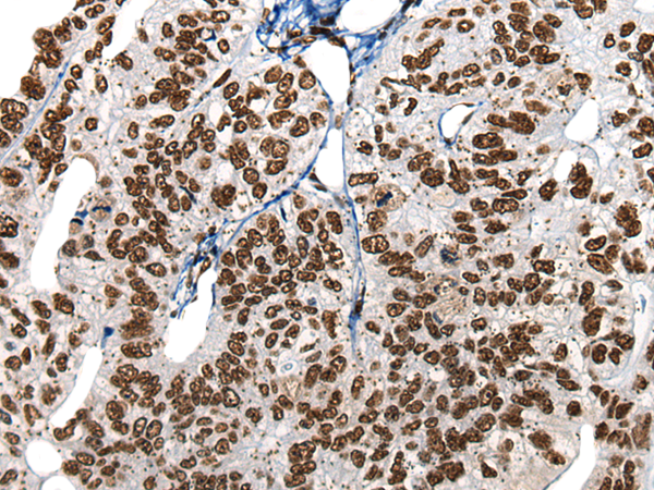 Rabbit Polyclonal Antibody to HNRNPR