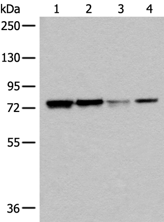 Rabbit Polyclonal Antibody to DYRK1A