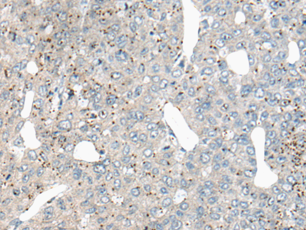 Rabbit Polyclonal Antibody to ATG2A