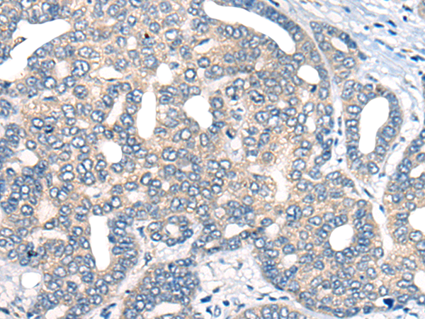 Rabbit Polyclonal Antibody to AURKA