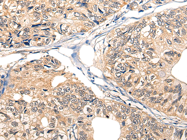 Rabbit Polyclonal Antibody to MST1R