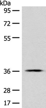 Rabbit Polyclonal Antibody to GPR55