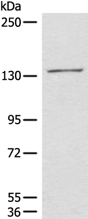Rabbit Polyclonal Antibody to HIPK2