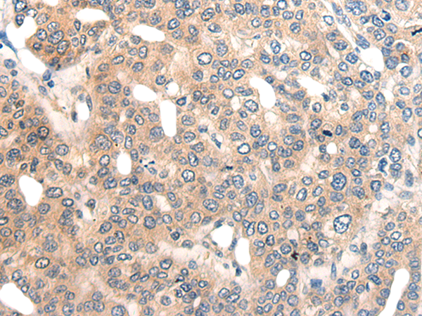Rabbit Polyclonal Antibody to IER3