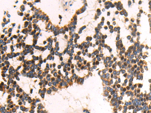 Rabbit Polyclonal Antibody to KLF2