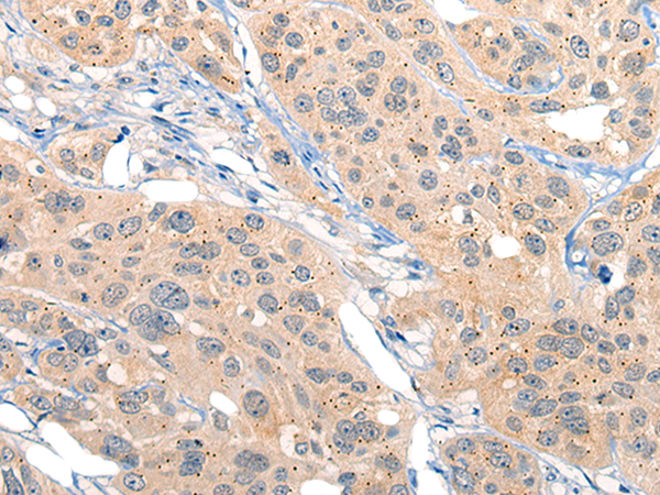 Rabbit Polyclonal Antibody to MIIP